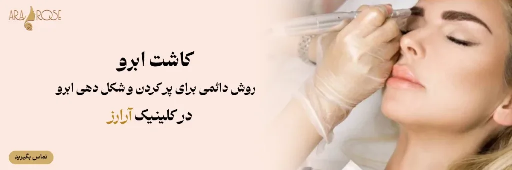 کاشت ابرو در کلینیک آرارز