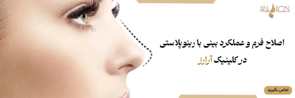 جراحی بینی در کلینیک آرارز
