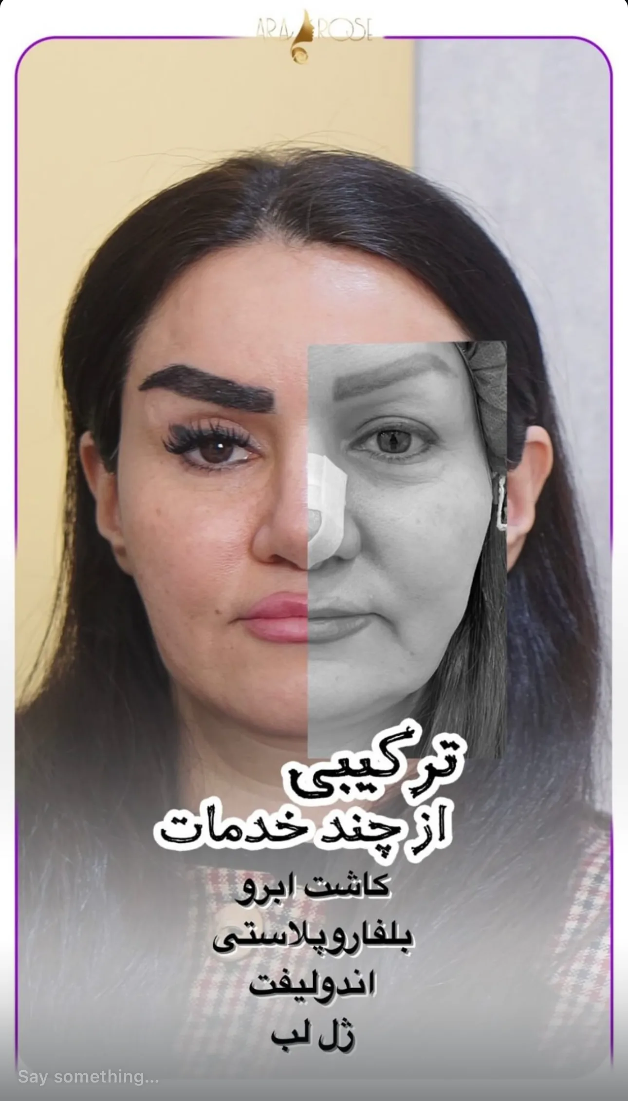 نتایج اندولیفت