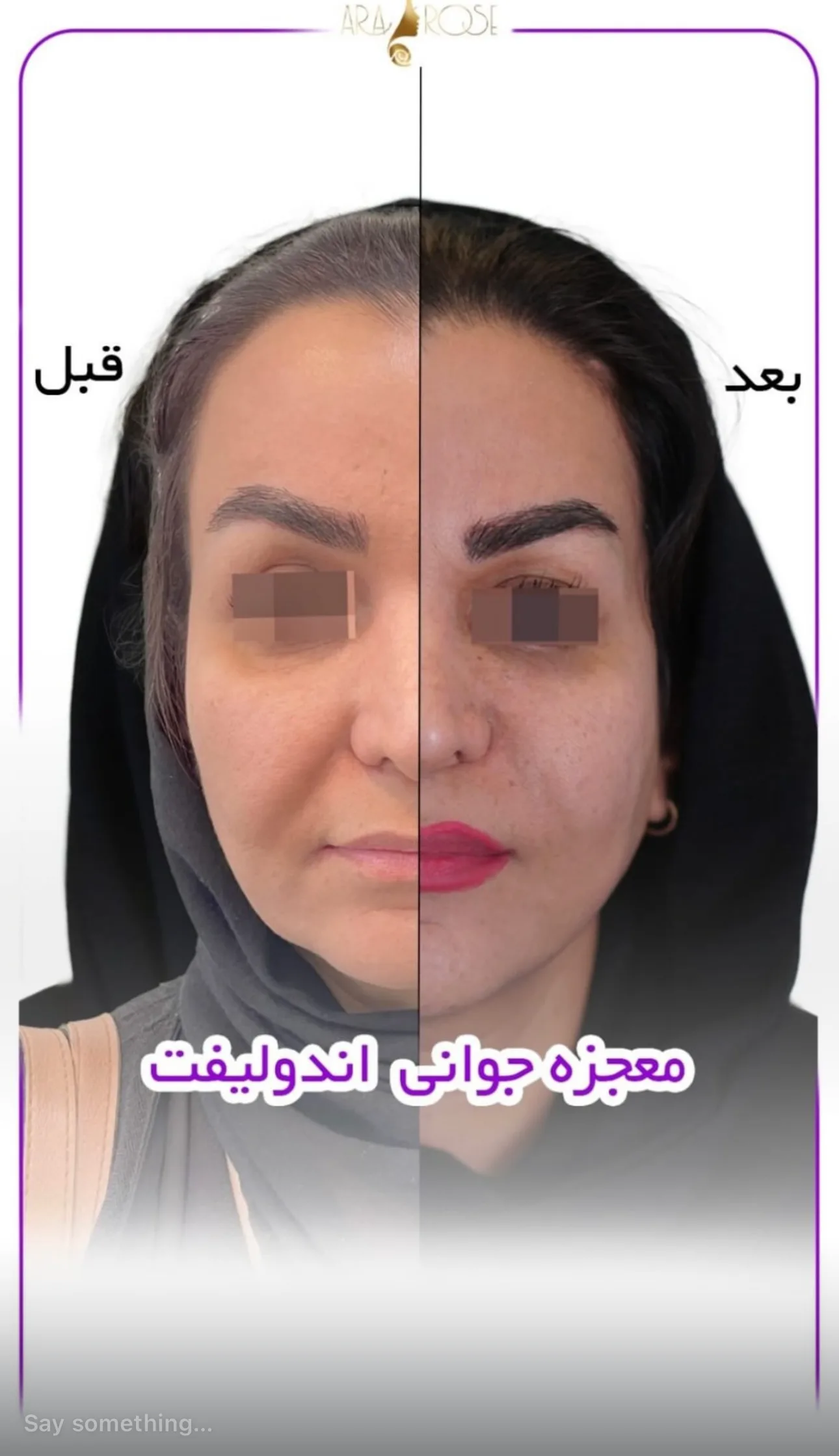 نتایج اندولیفت