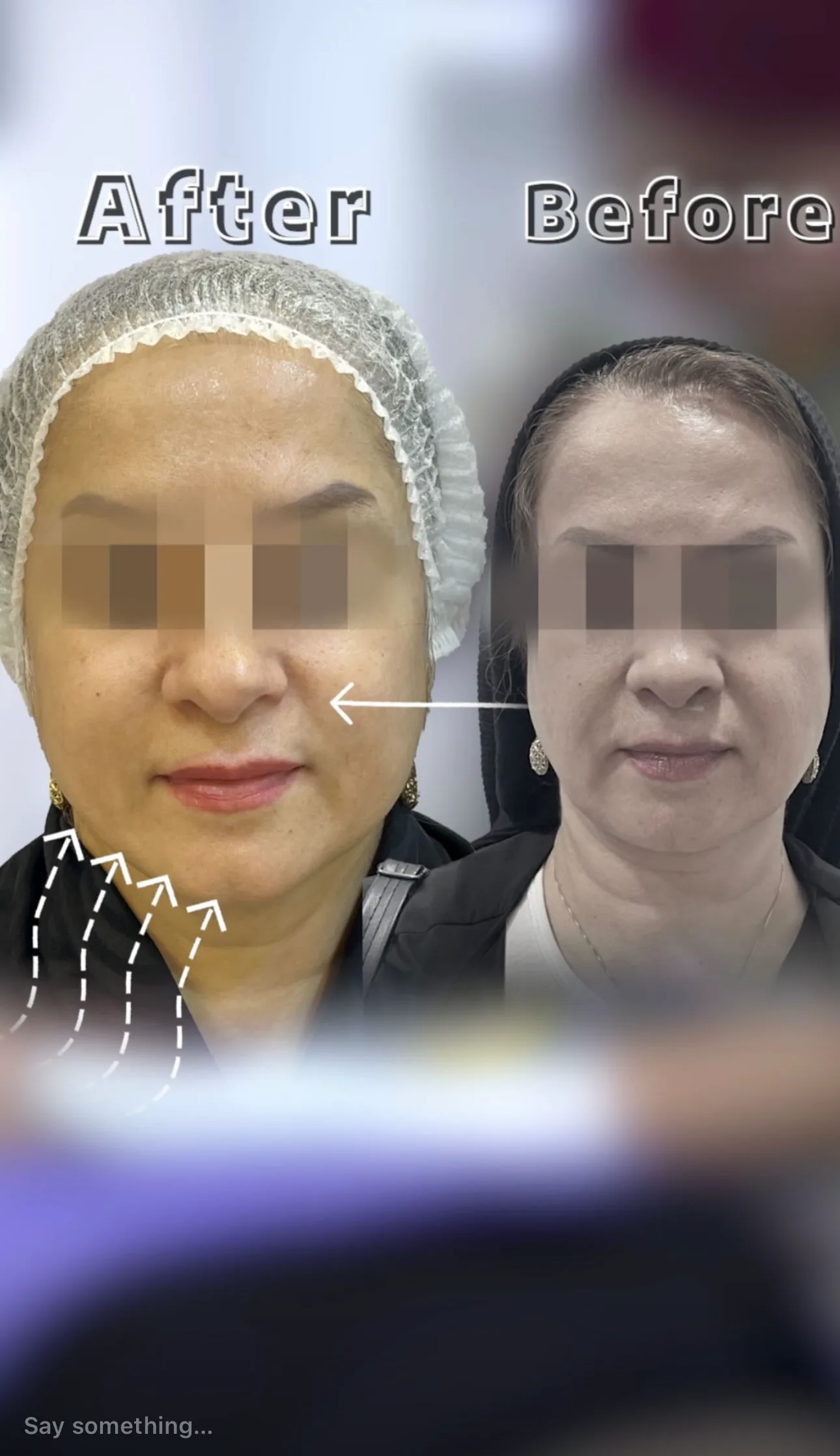 نتایج اندولیفت