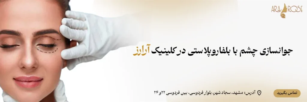 بلفاروپلاستی در کلینیک آرارز