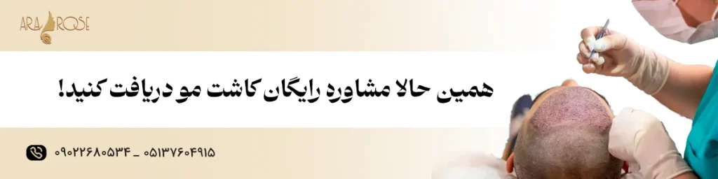 قیمت کاشت مو سر