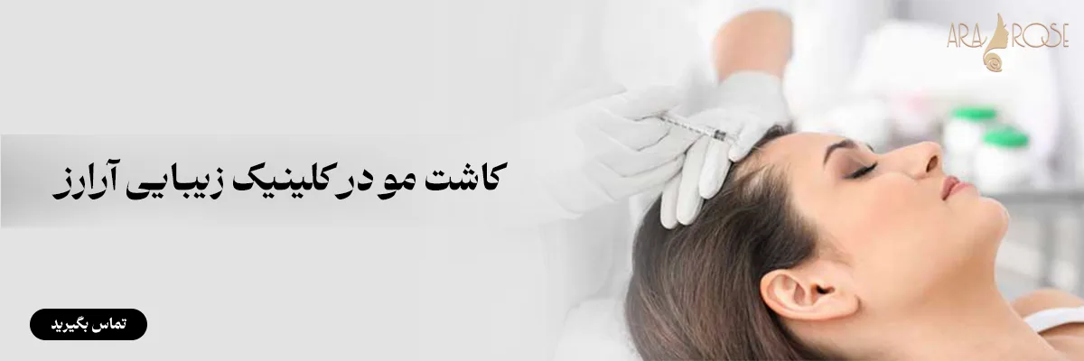 کاشت مو آرارز