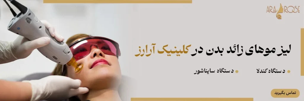 لیزر موهای زائد در مشهد