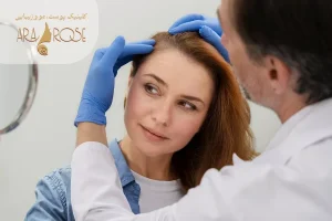 معاینه کاشت موی جلو سر