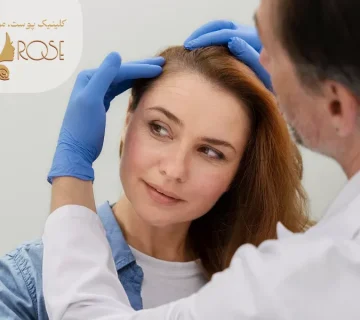 معاینه کاشت موی جلو سر